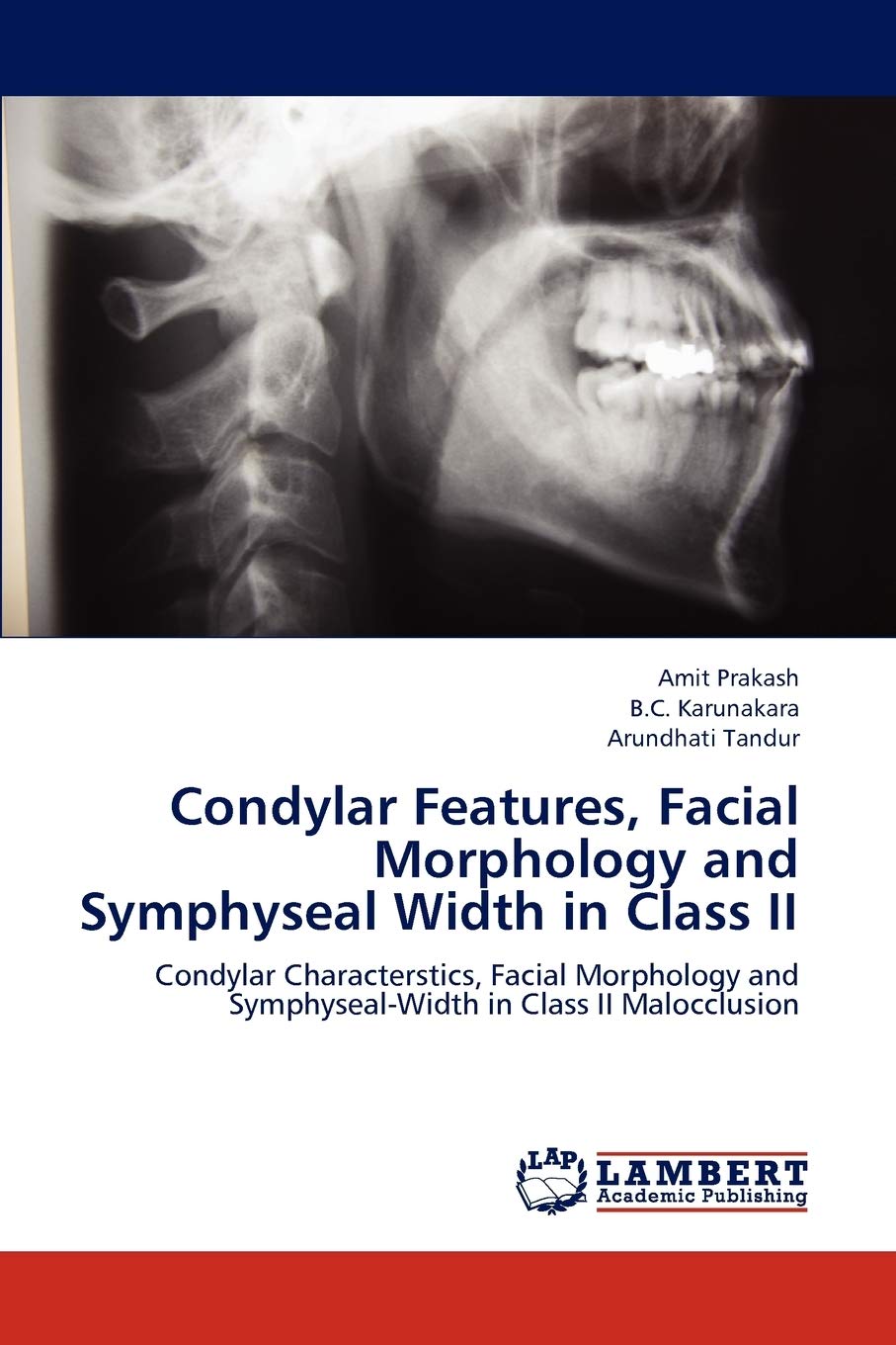 Condylar Features, Facial Morphology and Symphyseal Width in Class II: Condylar Characterstics, Facial Morphology and Symphyseal,Used