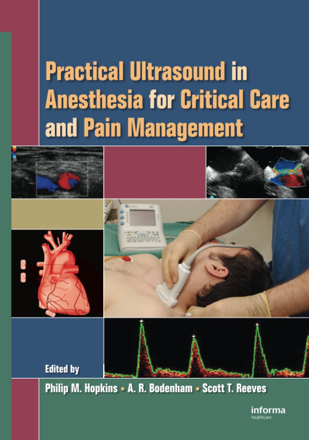Practical Ultrasound in Anesthesia for Critical Care and Pain Management,Used