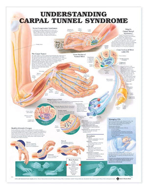 Understanding Carpal Tunnel Syndrome Anatomical Chart,New