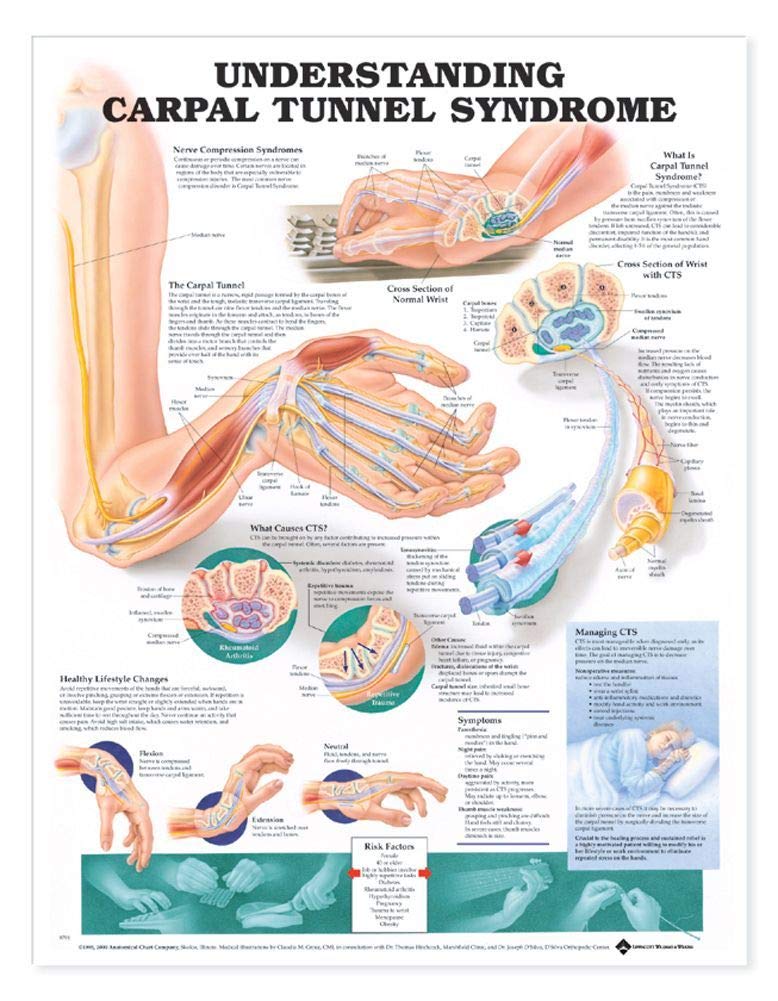 Understanding Carpal Tunnel Syndrome Anatomical Chart,New