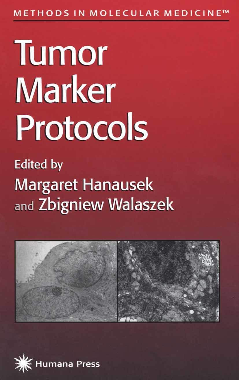 Tumor Marker Protocols (Methods in Molecular Medicine, 14),Used