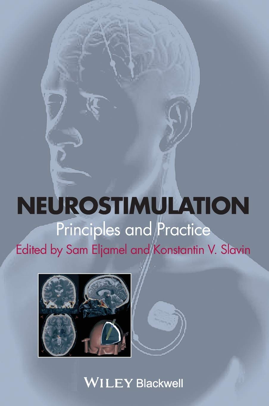 Neurostimulation: Principles And Practice