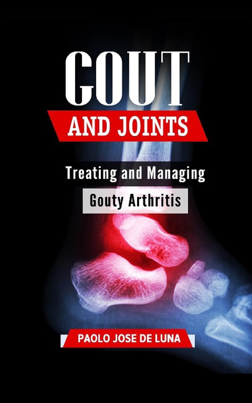 Gout And Joints: Treating and Managing Gouty Arthritis,Used