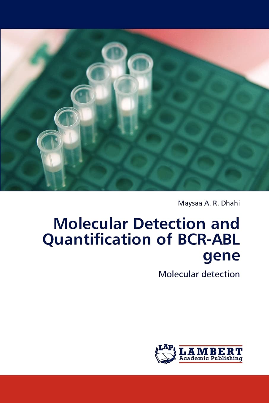 Molecular Detection and Quantification of BCRABL gene: Molecular detection,Used