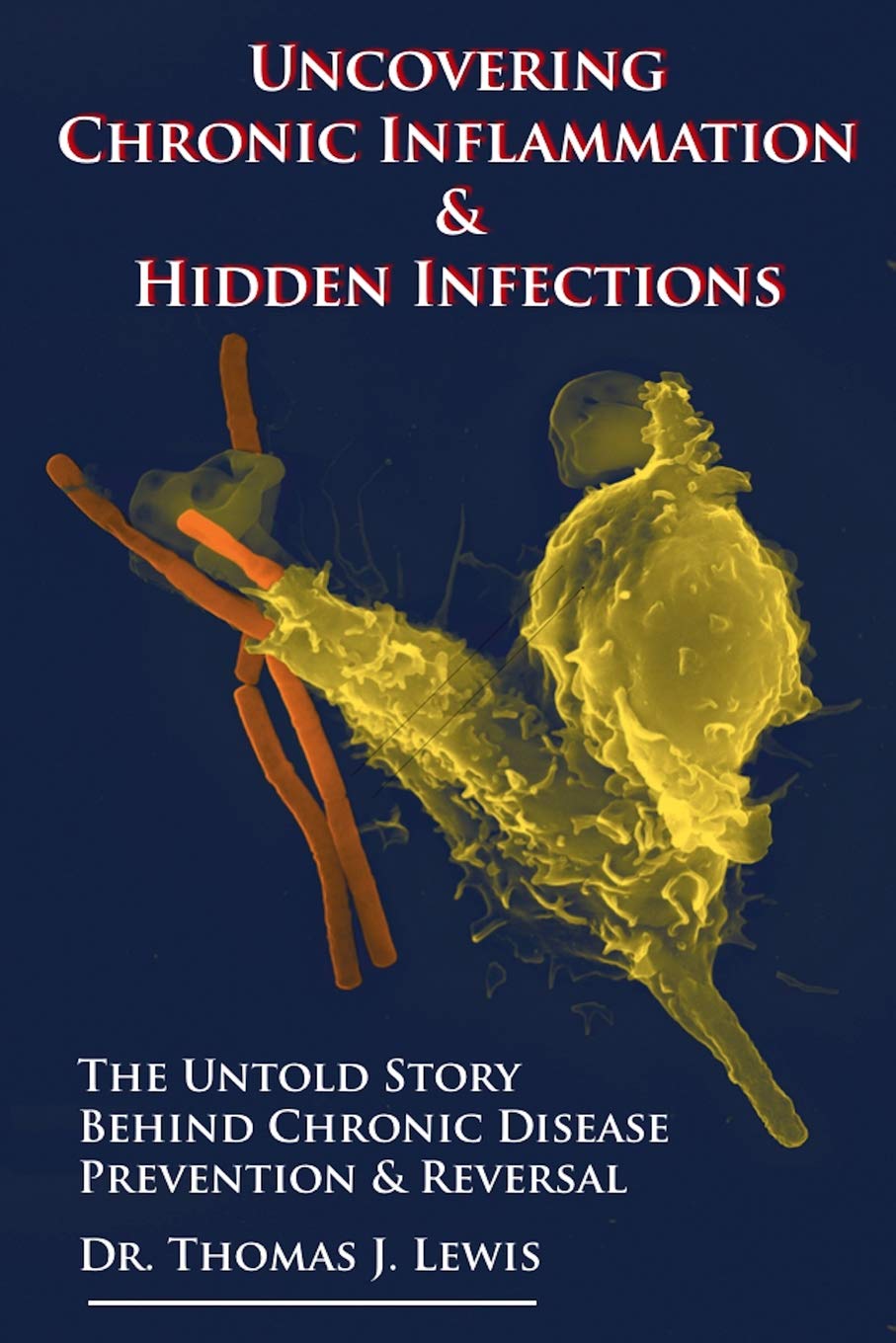 Uncovering Chronic Inflammation & Hidden Infections: The Untold Story Behind Chronic Disease Prevention & Reversal,Used