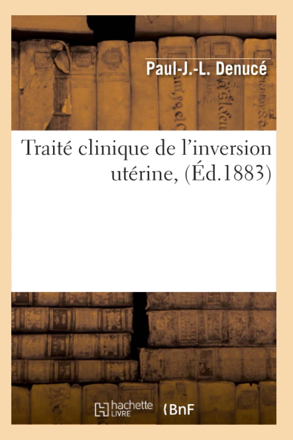 Trait Clinique de l'Inversion Utrine, (d.1883) (Sciences) (French Edition),Used
