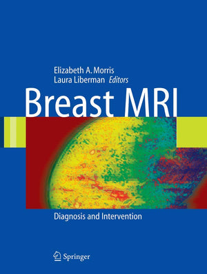 Breast MRI: Diagnosis and Intervention,Used