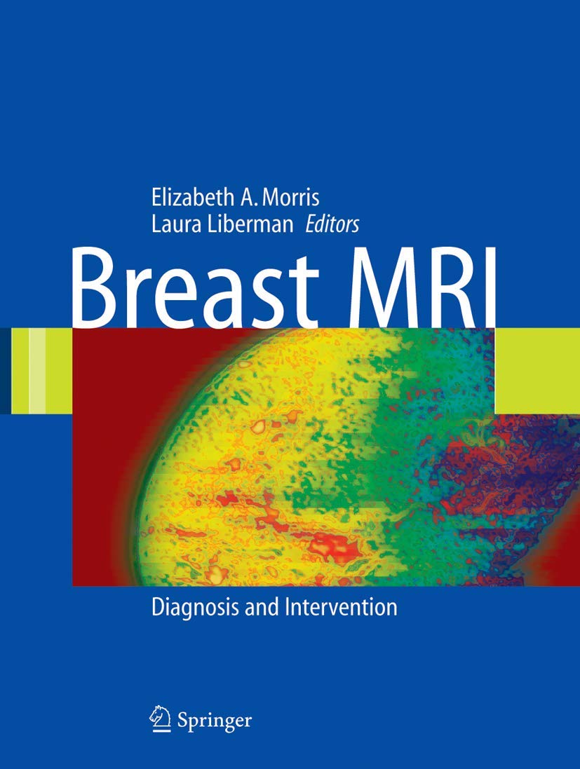Breast MRI: Diagnosis and Intervention,Used