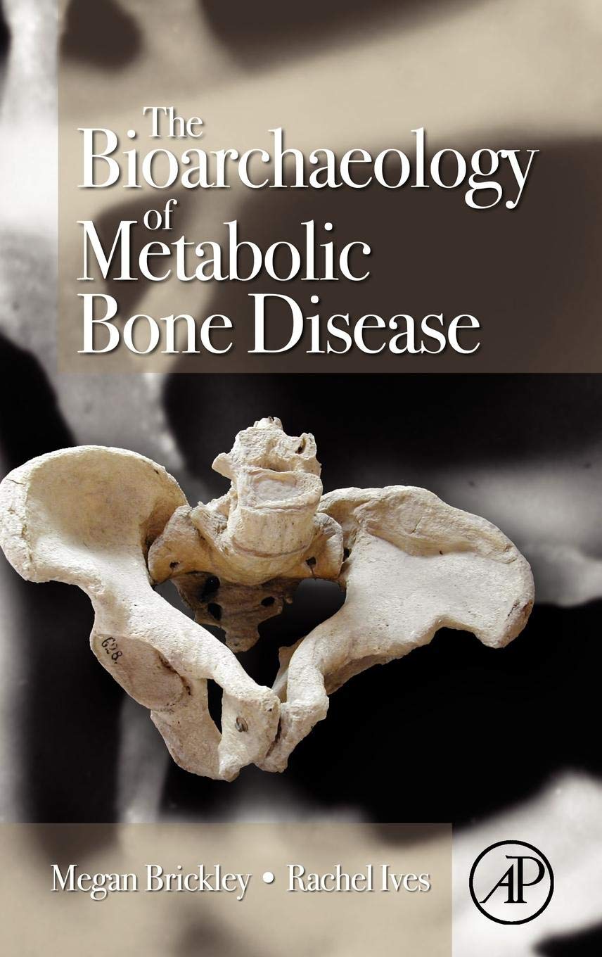 The Bioarchaeology of Metabolic Bone Disease,Used