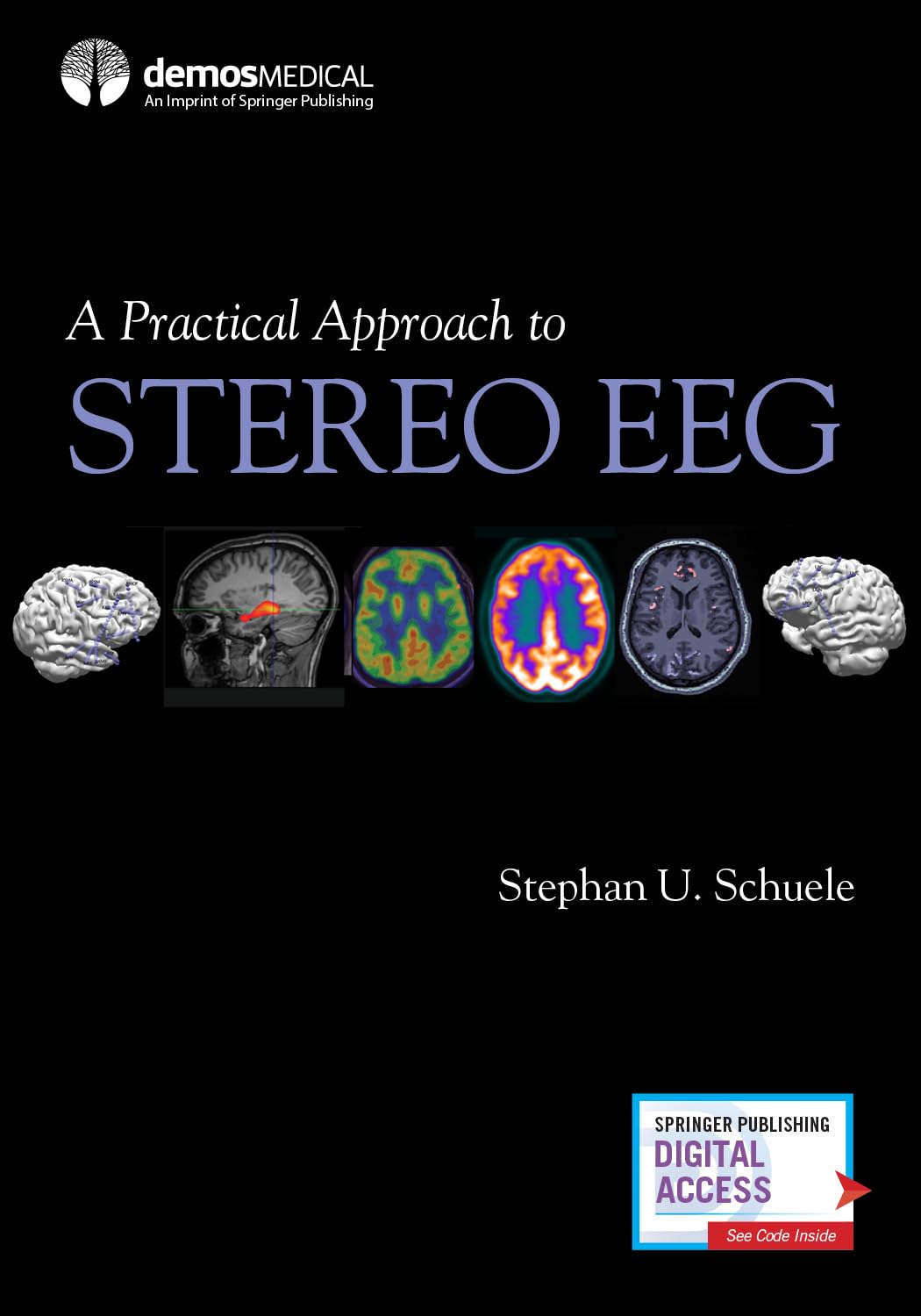 A Practical Approach to Stereo EEG,Used