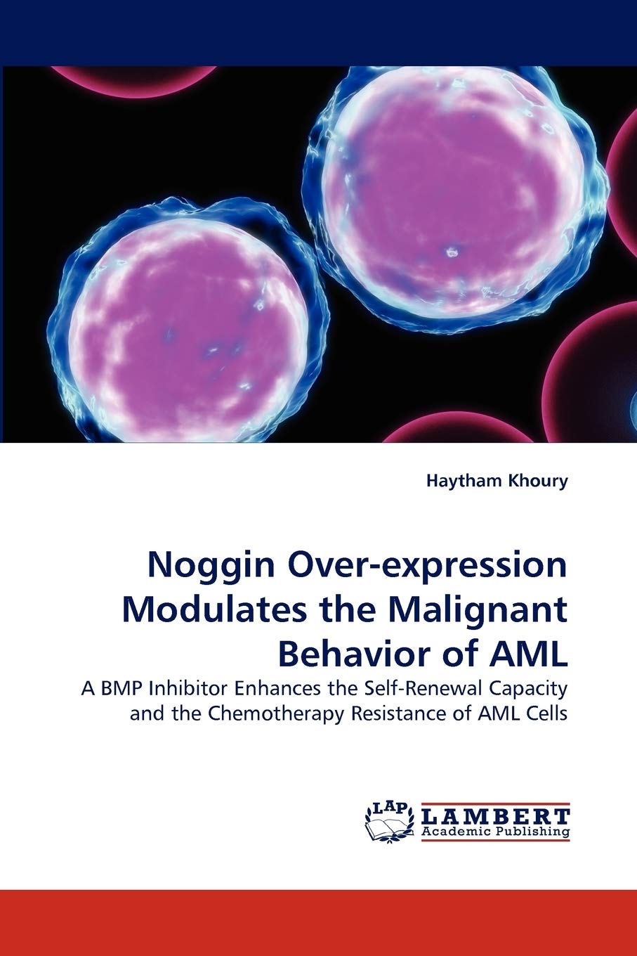 Noggin Overexpression Modulates the Malignant Behavior of AML: A BMP Inhibitor Enhances the SelfRenewal Capacity and the Chemo,Used