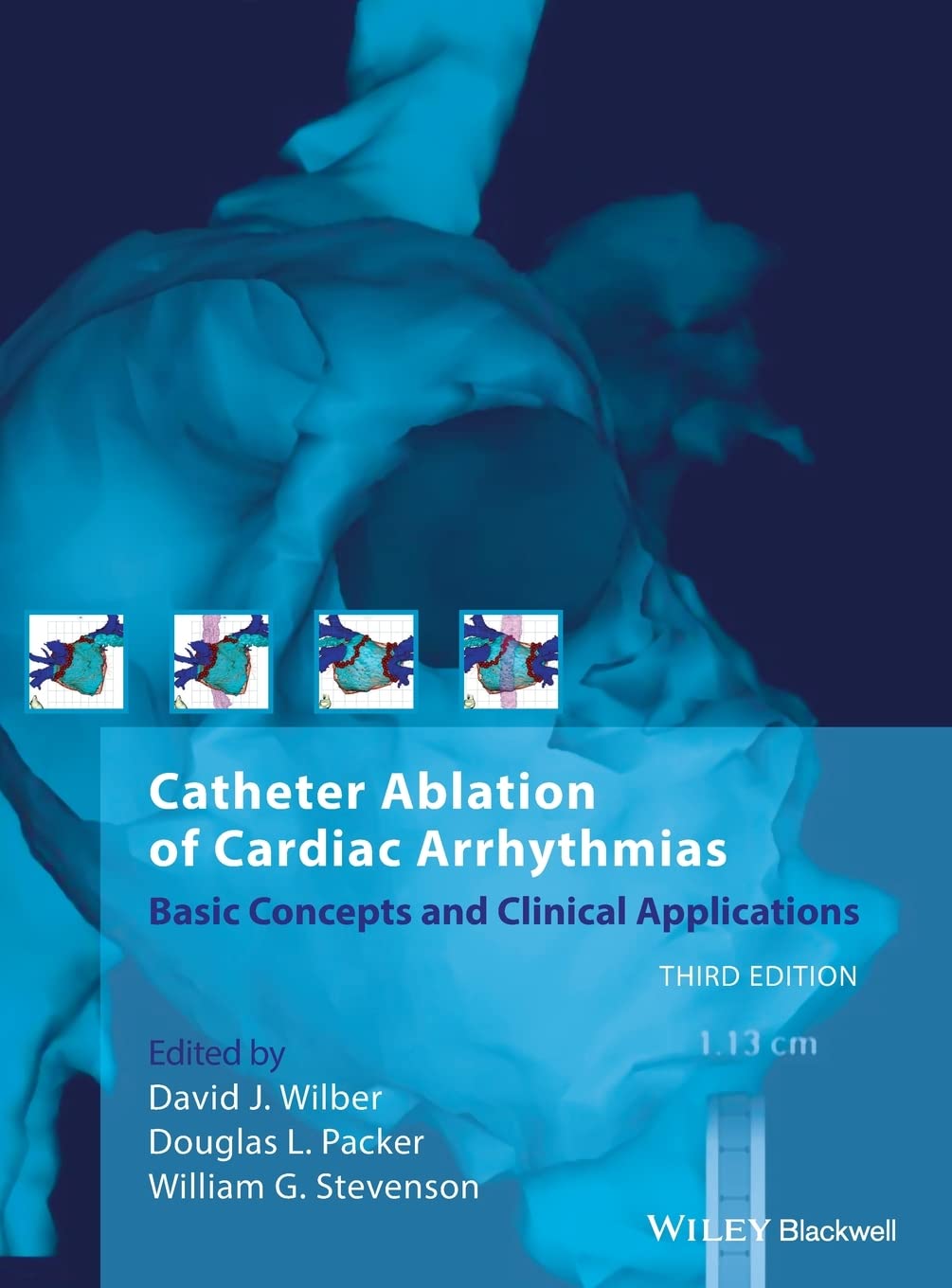 Catheter Ablation of Cardiac Arrhythmias,Used