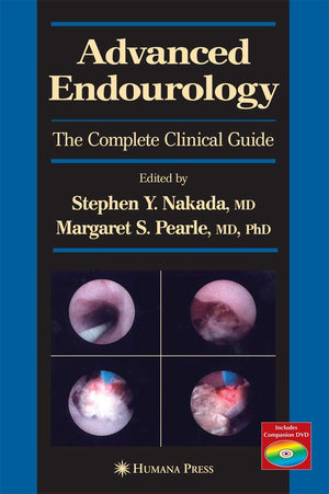 Advanced Endourology: The Complete Clinical Guide (Current Clinical Urology),Used