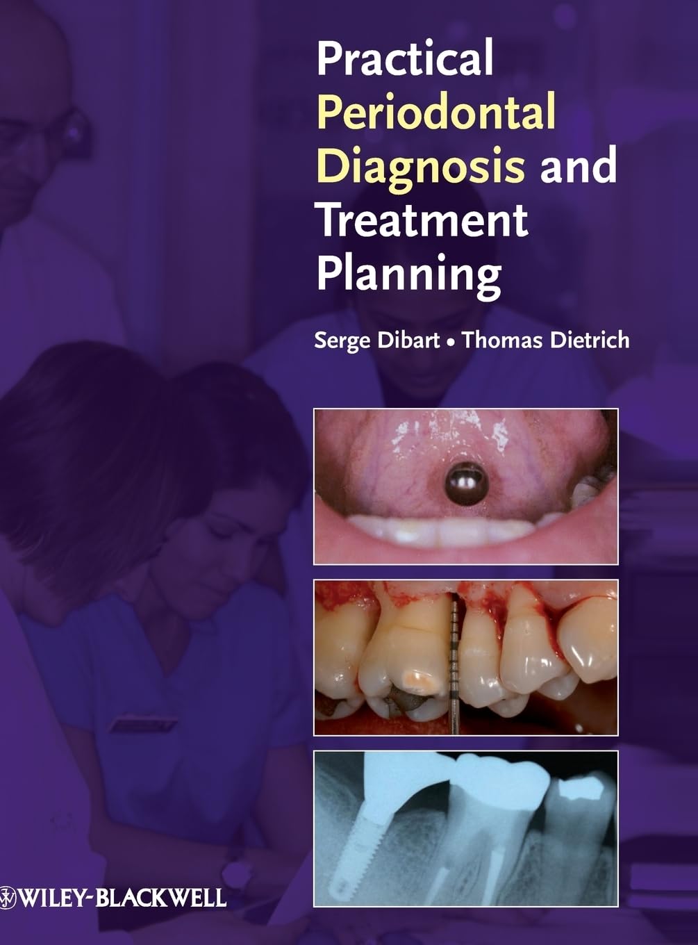 Practical Periodontal Diagnosis and Treatment Planning