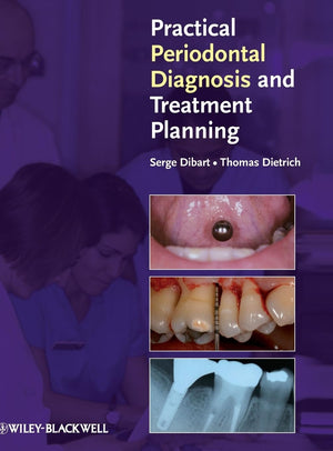 Practical Periodontal Diagnosis and Treatment Planning