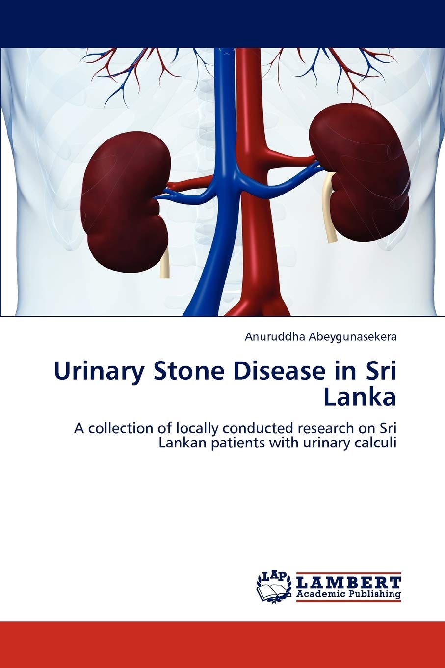 Urinary Stone Disease in Sri Lanka: A collection of locally conducted research on Sri Lankan patients with urinary calculi,Used