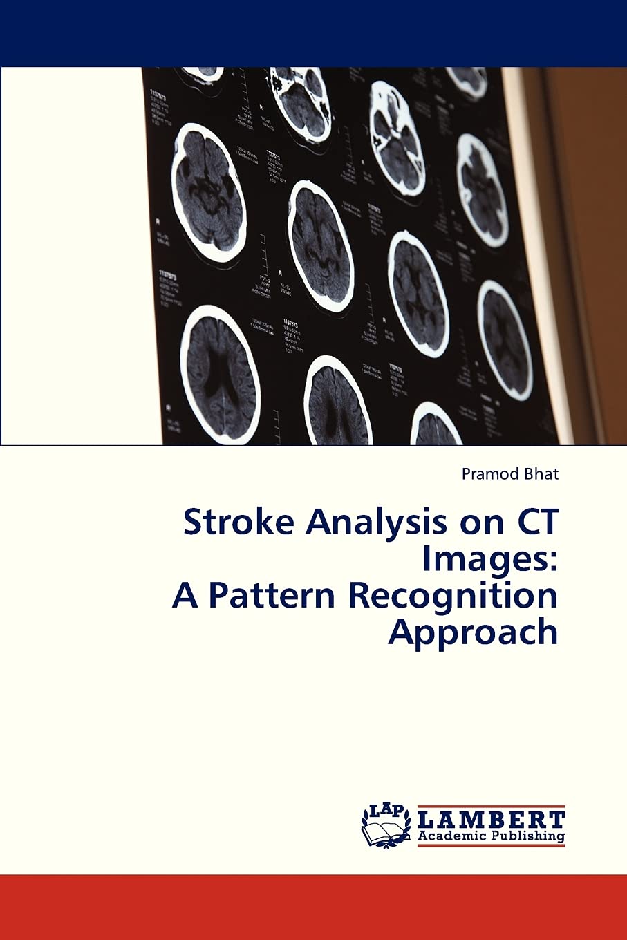 Stroke Analysis on CT Images: A Pattern Recognition Approach,Used