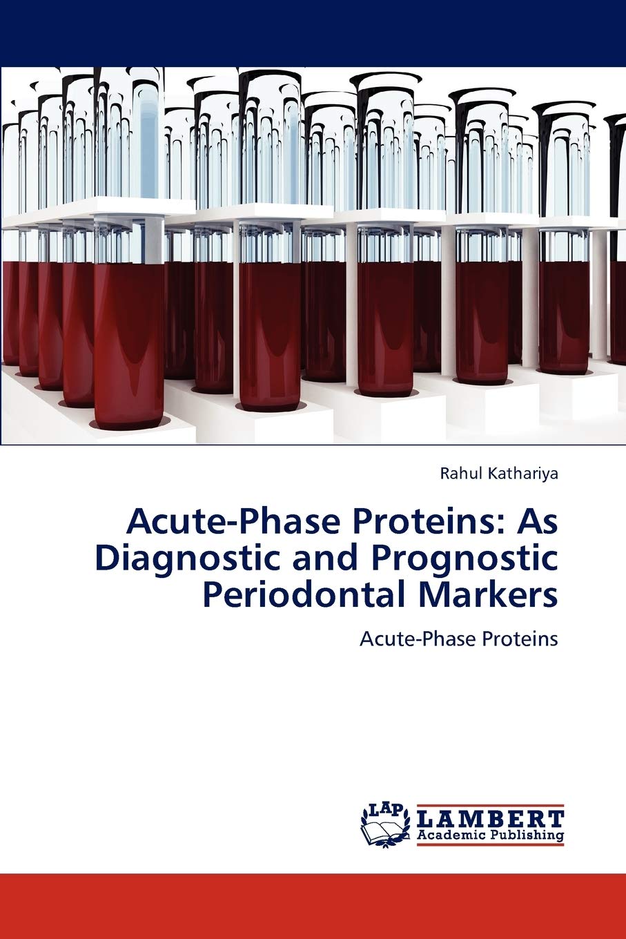 AcutePhase Proteins: As Diagnostic and Prognostic Periodontal Markers: AcutePhase Proteins,Used