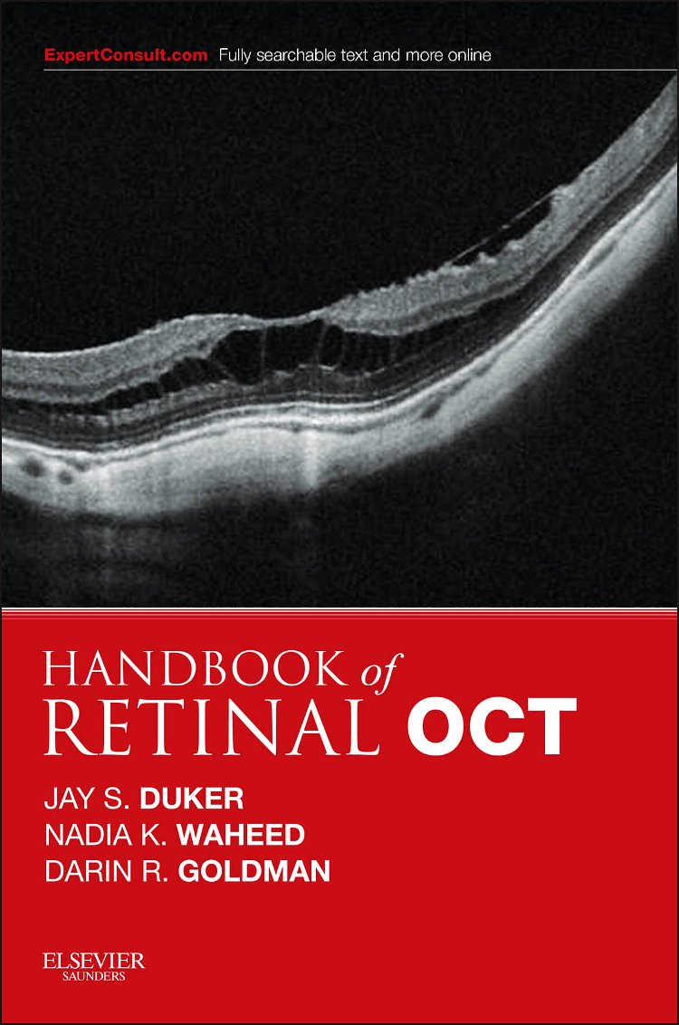 Handbook of Retinal OCT: Optical Coherence Tomography, 1e,Used
