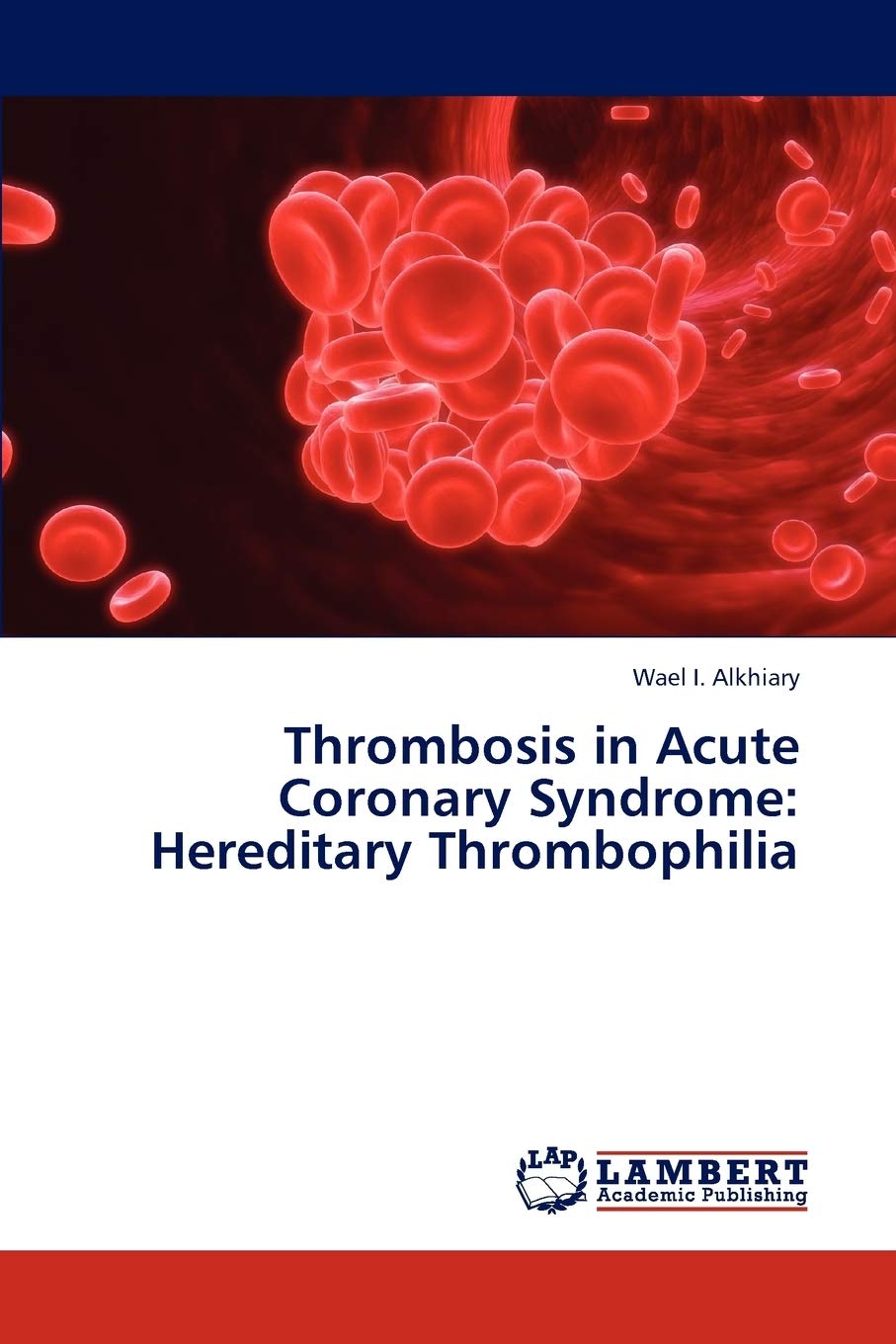 Thrombosis in Acute Coronary Syndrome: Hereditary Thrombophilia,Used