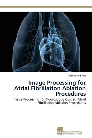 Image Processing for Atrial Fibrillation Ablation Procedures: Image Processing for Fluoroscopy Guided Atrial Fibrillation Ablati,Used
