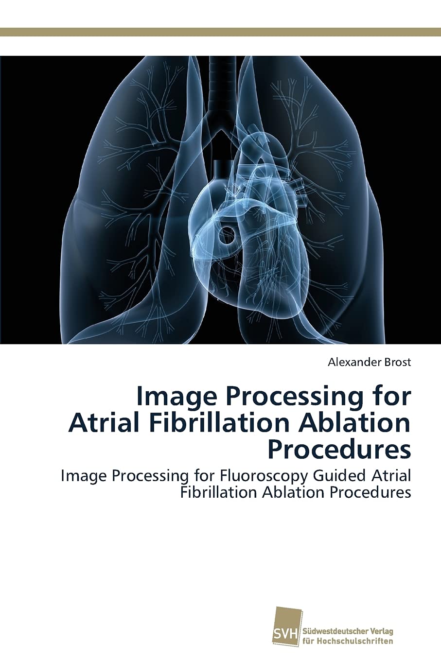 Image Processing for Atrial Fibrillation Ablation Procedures: Image Processing for Fluoroscopy Guided Atrial Fibrillation Ablati,Used