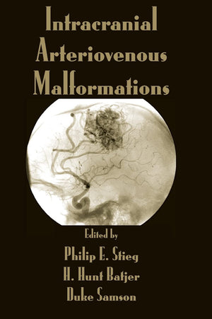 Intracranial Arteriovenous Malformations,Used