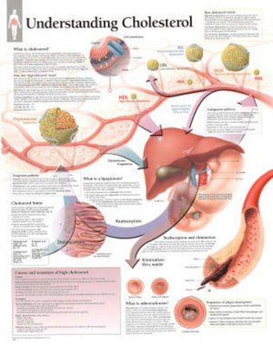Understanding Cholesterol chart: Laminated Wall Chart,Used