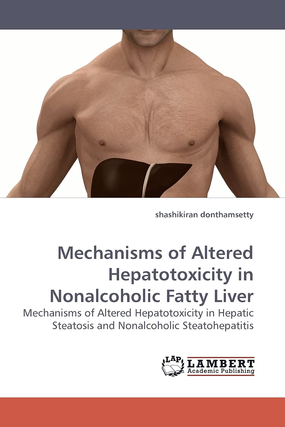 Mechanisms of Altered Hepatotoxicity in Nonalcoholic Fatty Liver: Mechanisms of Altered Hepatotoxicity in Hepatic Steatosis and ,Used
