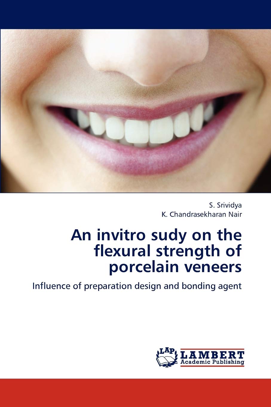 An invitro sudy on the flexural strength of porcelain veneers: Influence of preparation design and bonding agent,Used