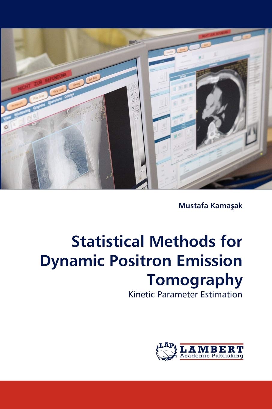Statistical Methods for Dynamic Positron Emission Tomography: Kinetic Parameter Estimation,Used