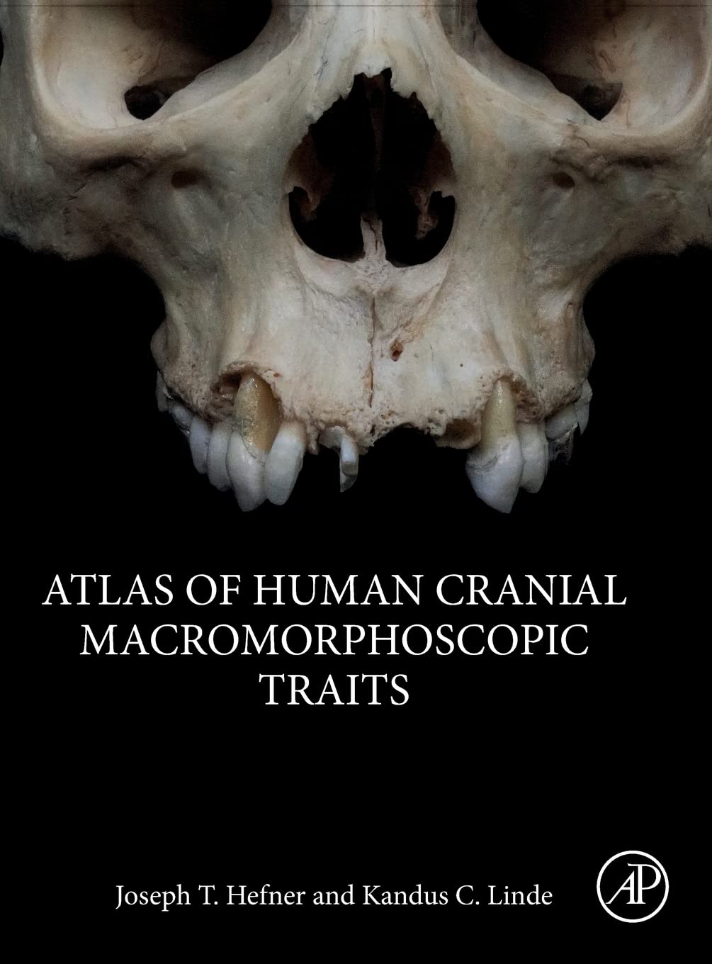 Atlas of Human Cranial Macromorphoscopic Traits,Used