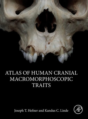 Atlas of Human Cranial Macromorphoscopic Traits,Used