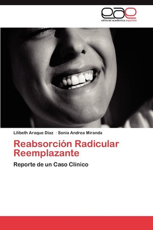 Reabsorcin Radicular Reemplazante: Reporte de un Caso Clnico (Spanish Edition),Used