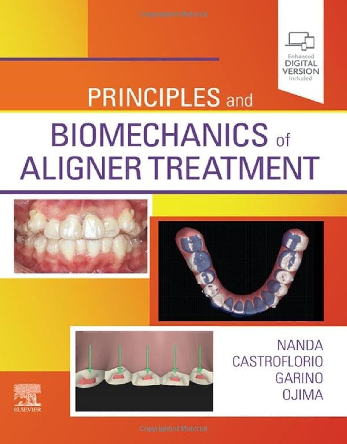 Principles and Biomechanics of Aligner Treatment,Used
