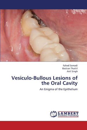 VesiculoBullous Lesions of the Oral Cavity: An Enigma of the Epithelium,Used