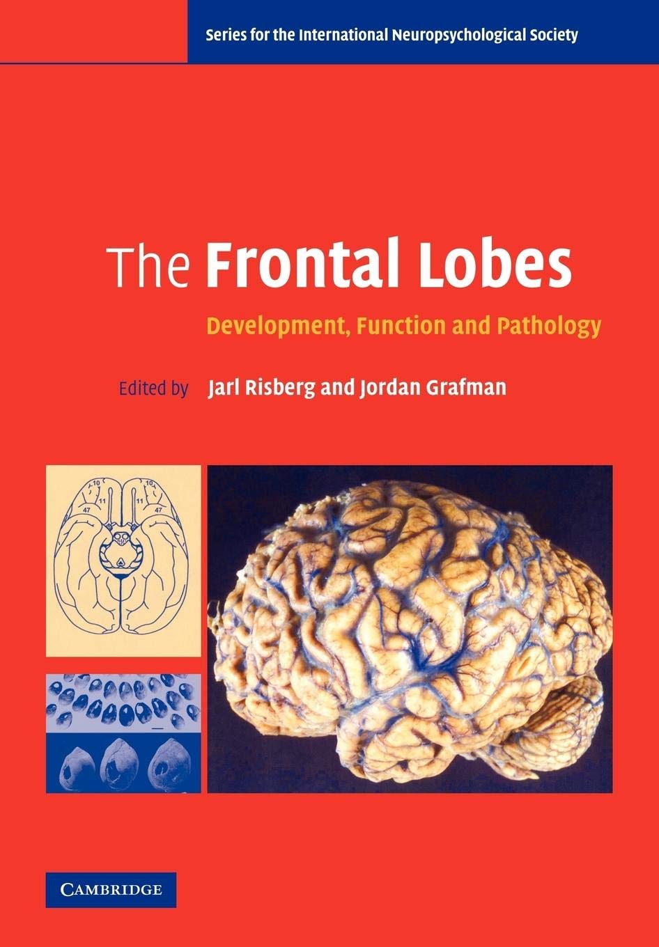 The Frontal Lobes: Development, Function and Pathology (Series for the International Neuropsychological Society),Used