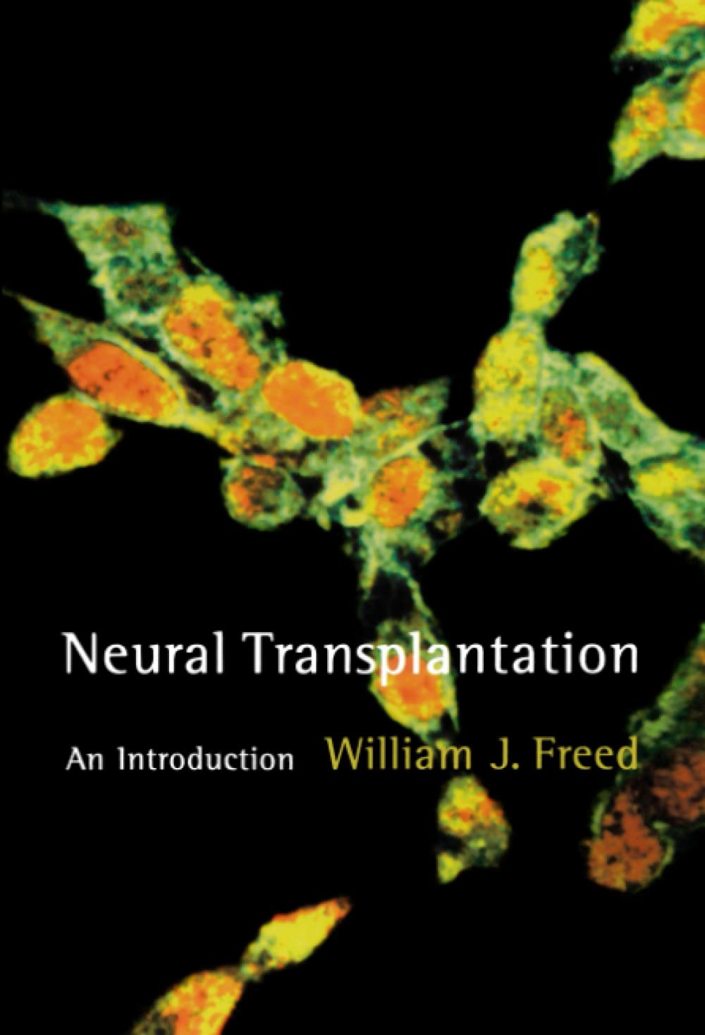 Neural Transplantation: An Introduction (Bradford Books)