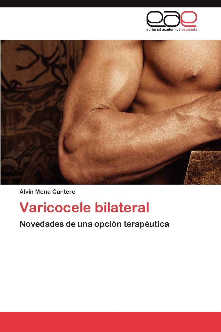 Varicocele bilateral: Novedades de una opcin teraputica (Spanish Edition),Used