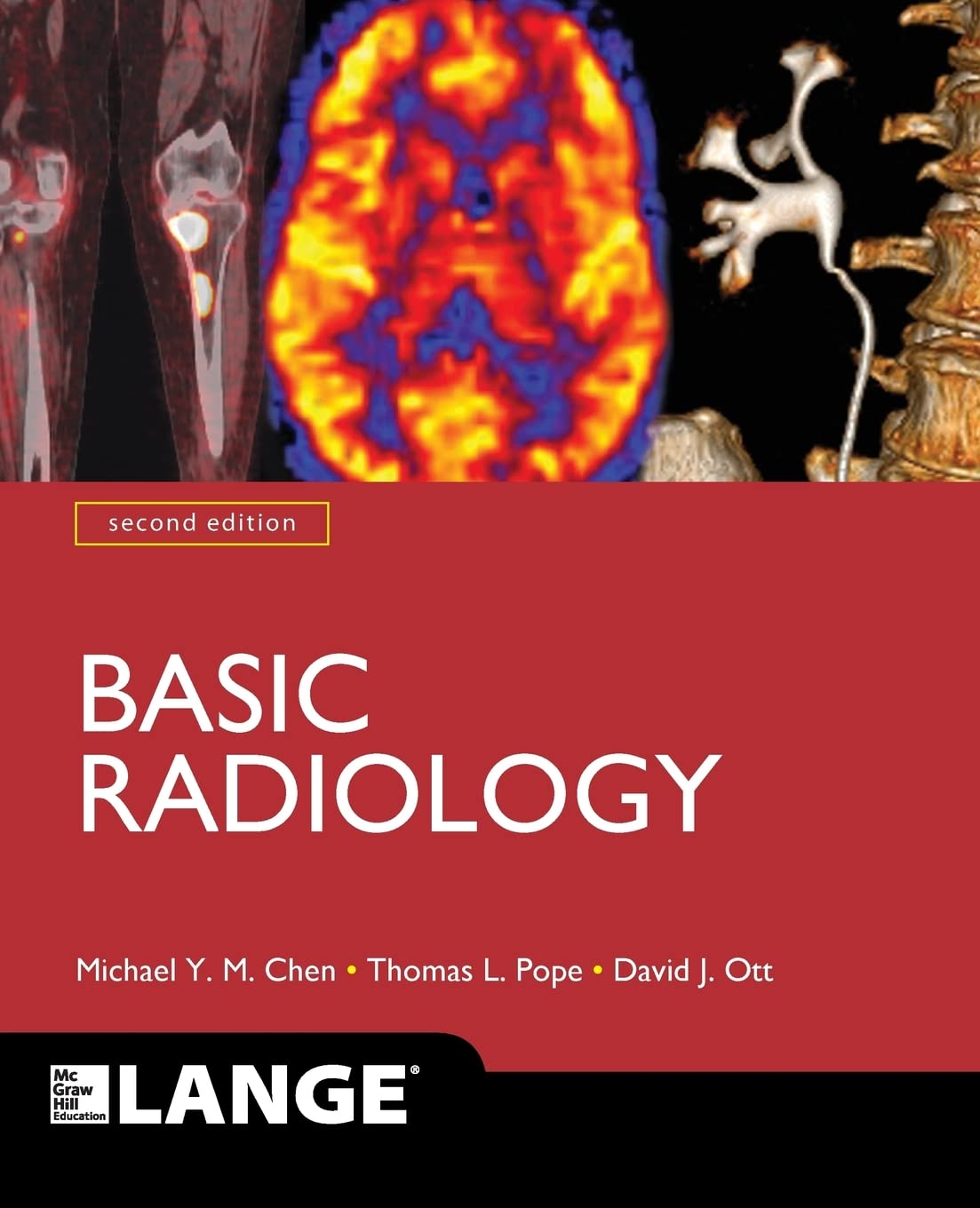 Basic Radiology, Second Edition (LANGE Clinical Medicine),Used