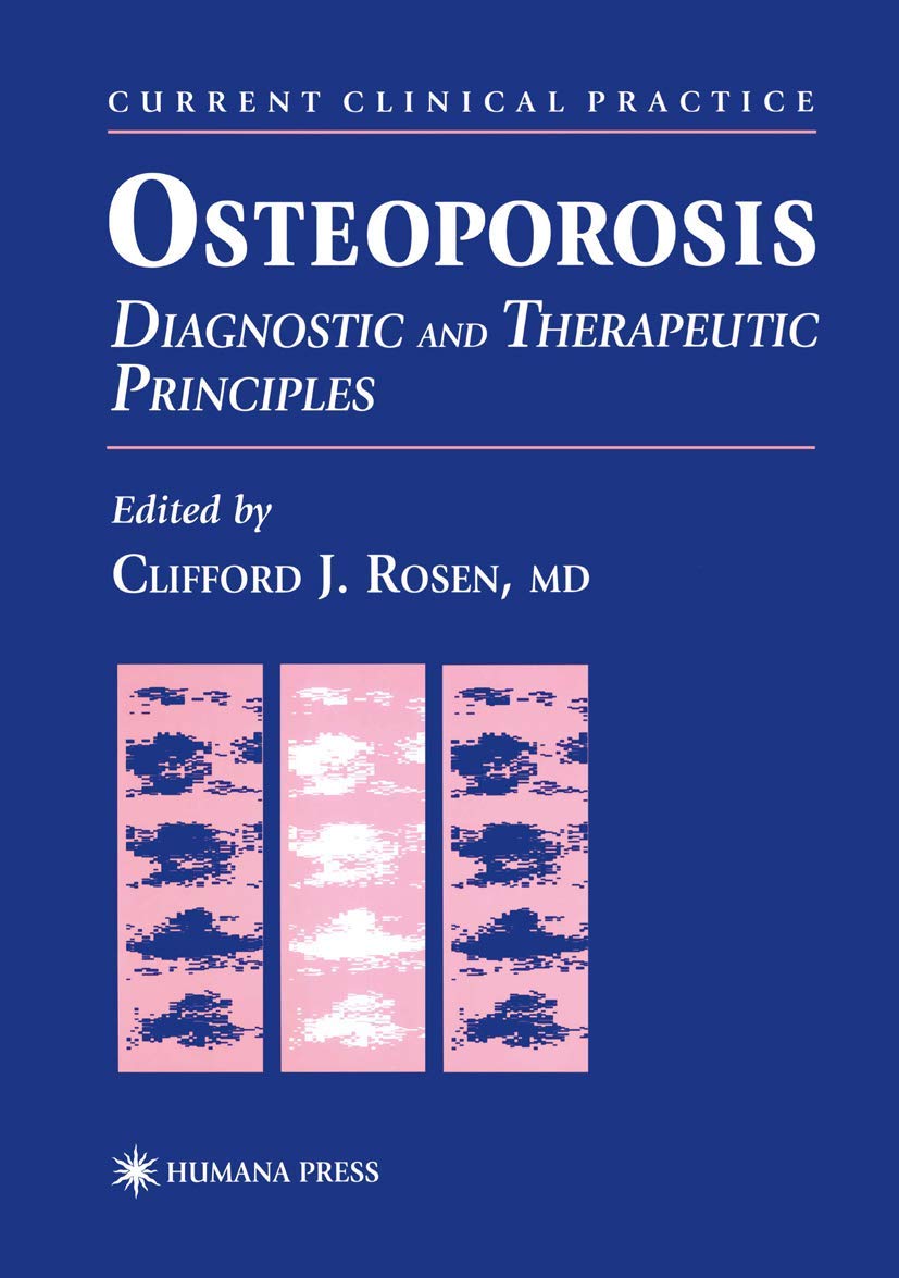 Osteoporosis: Diagnostic and Therapeutic Principles (Current Clinical Practice),Used