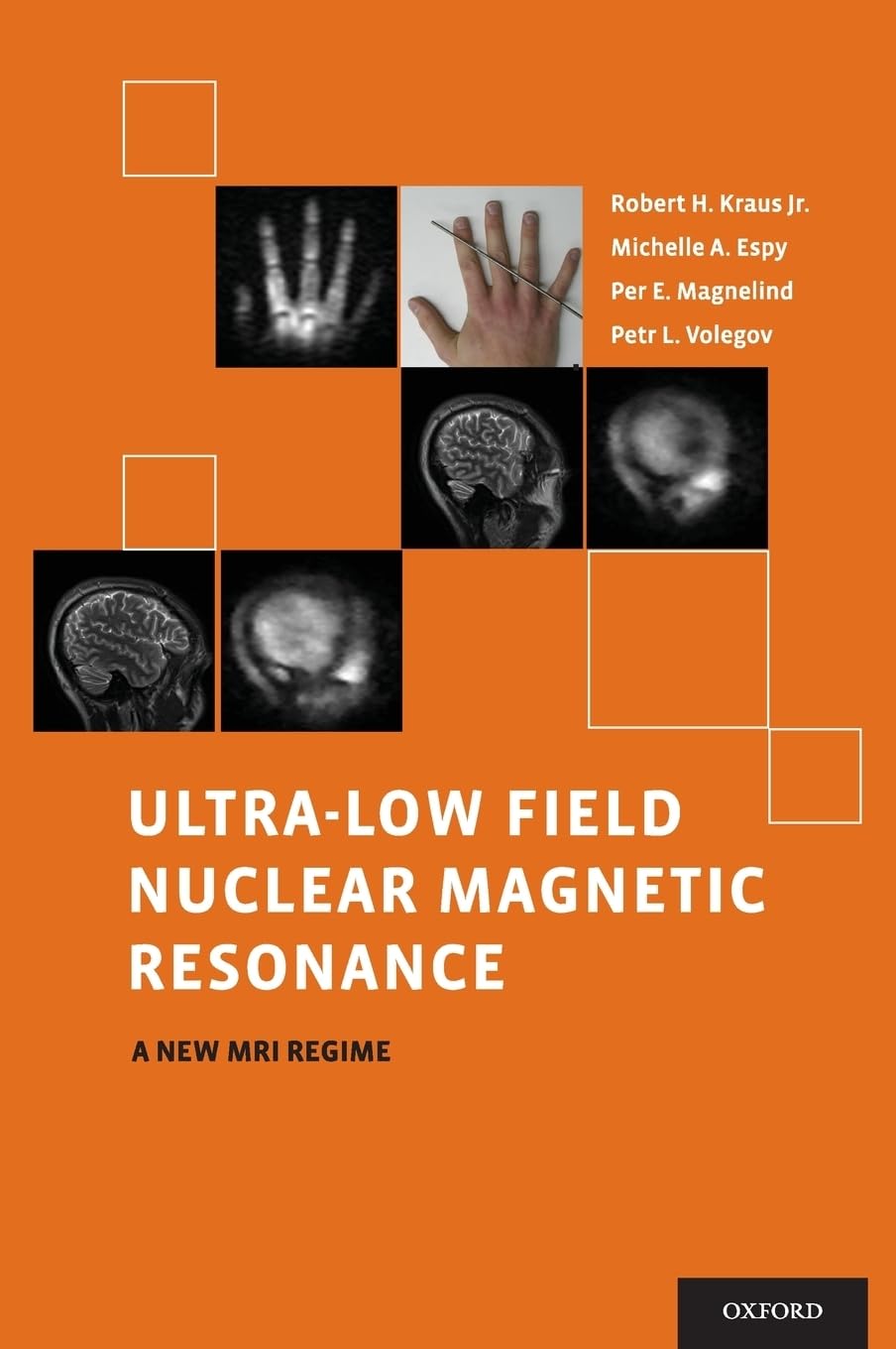 UltraLow Field Nuclear Magnetic Resonance: A New MRI Regime,Used