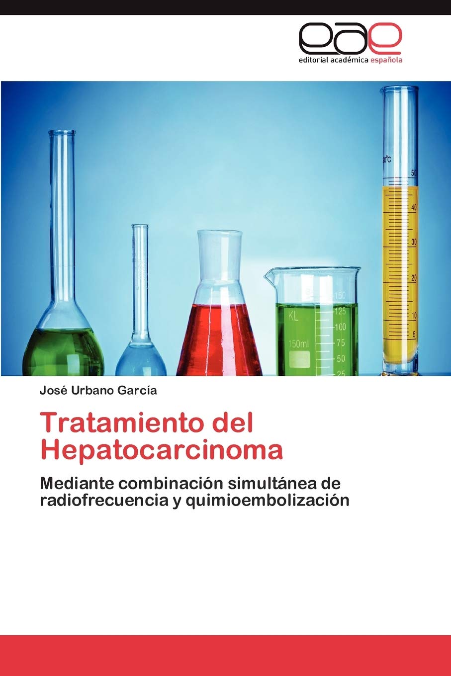 Tratamiento del Hepatocarcinoma: Mediante combinacin simultnea de radiofrecuencia y quimioembolizacin (Spanish Edition),Used