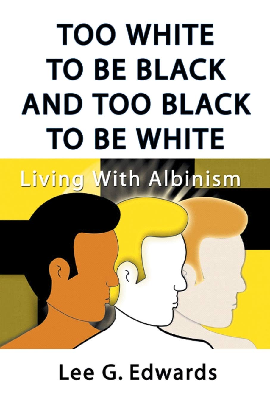 Too White to be Black and too Black to be White: Living with Albinism,Used