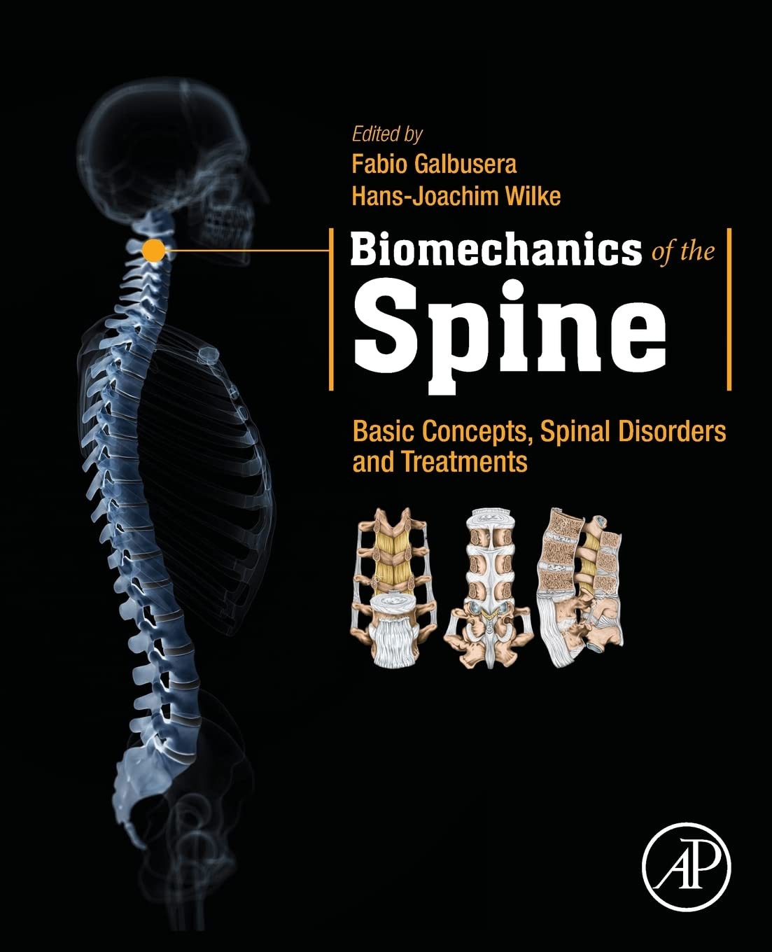 Biomechanics of the Spine: Basic Concepts, Spinal Disorders and Treatments,Used