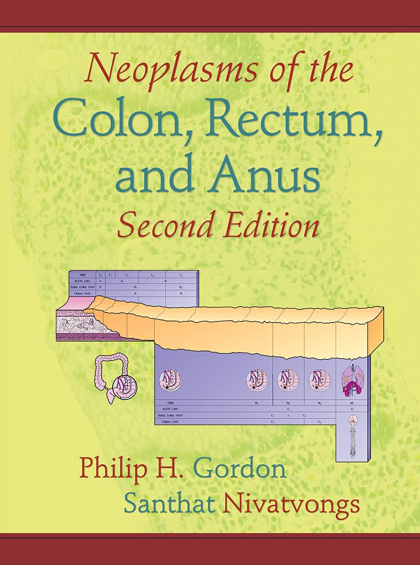 Neoplasms of the Colon, Rectum, and Anus,Used