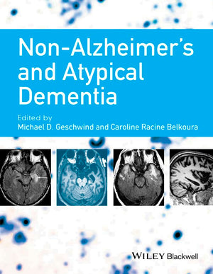 NonAlzheimer's and Atypical Dementia,Used