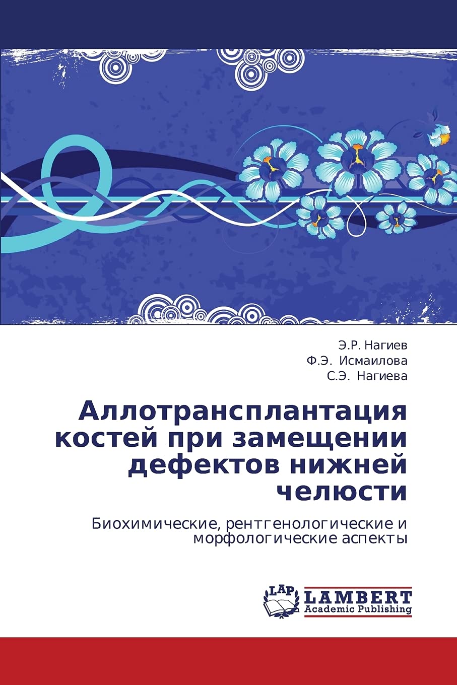 Allotransplantatsiya kostey pri zameshchenii defektov nizhney chelyusti: Biokhimicheskie, rentgenologicheskie i morfologicheskie,Used