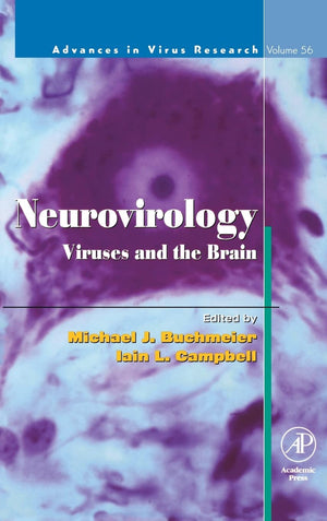 Neurovirology: Viruses And The Brain (Volume 56) (Advances In Virus Research, Volume 56)