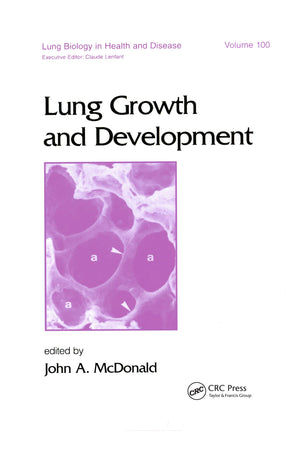 Lung Growth and Development (Lung Biology in Health and Disease),Used